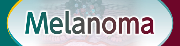 Melanoma