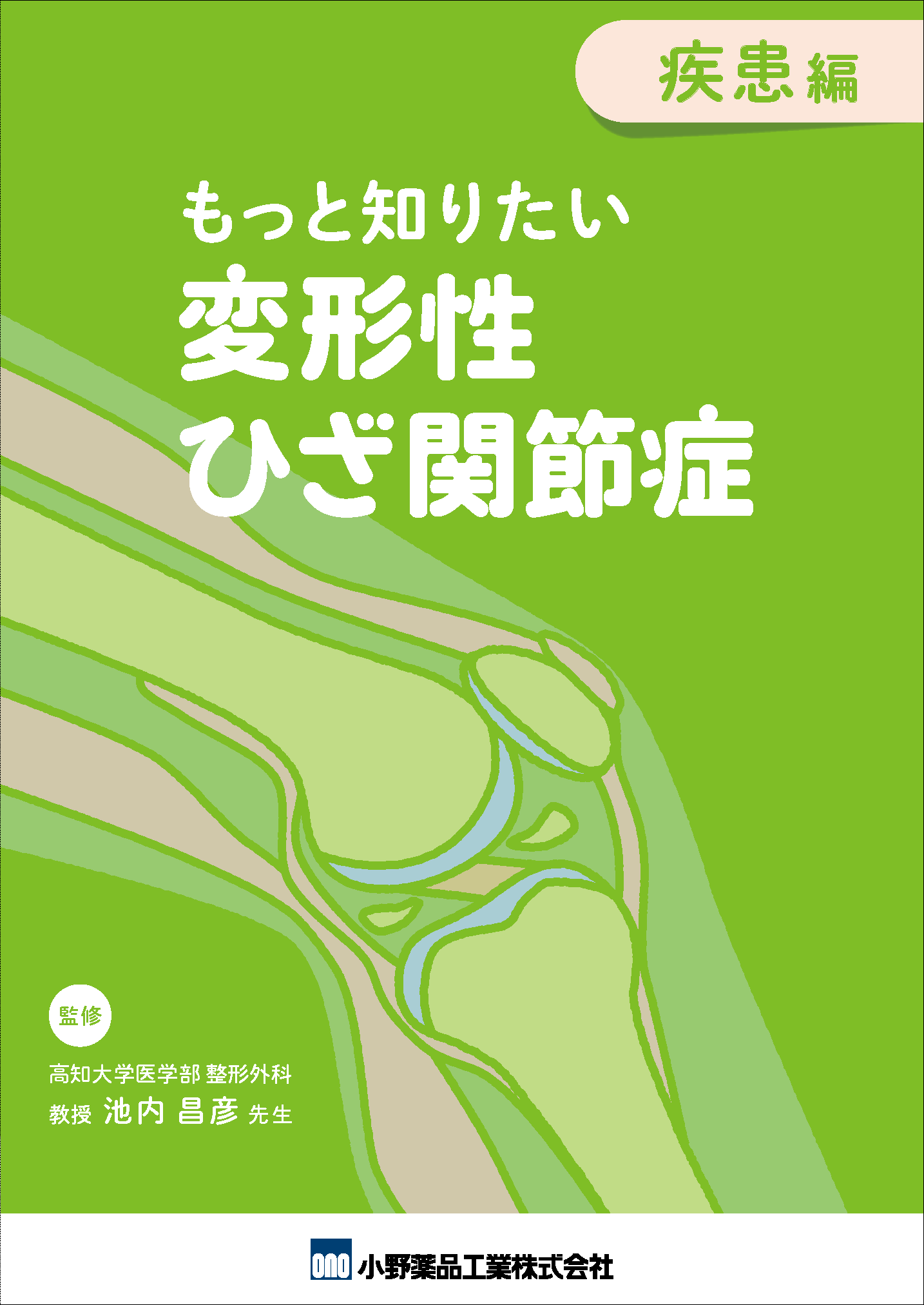 もっと知りたい 変形性ひざ関節症 疾患編